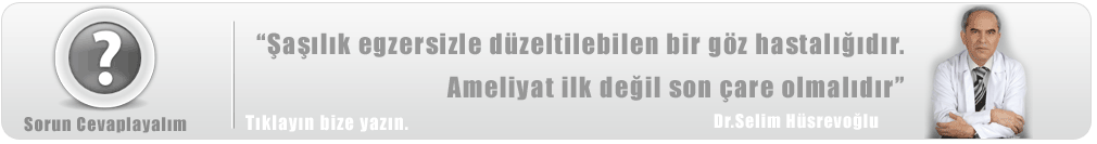 şaşı bebek